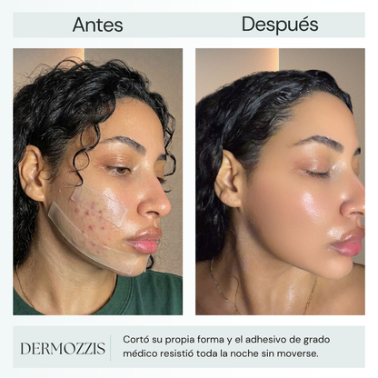 Dermozzis Apósito Corrector Hidrocoloide.